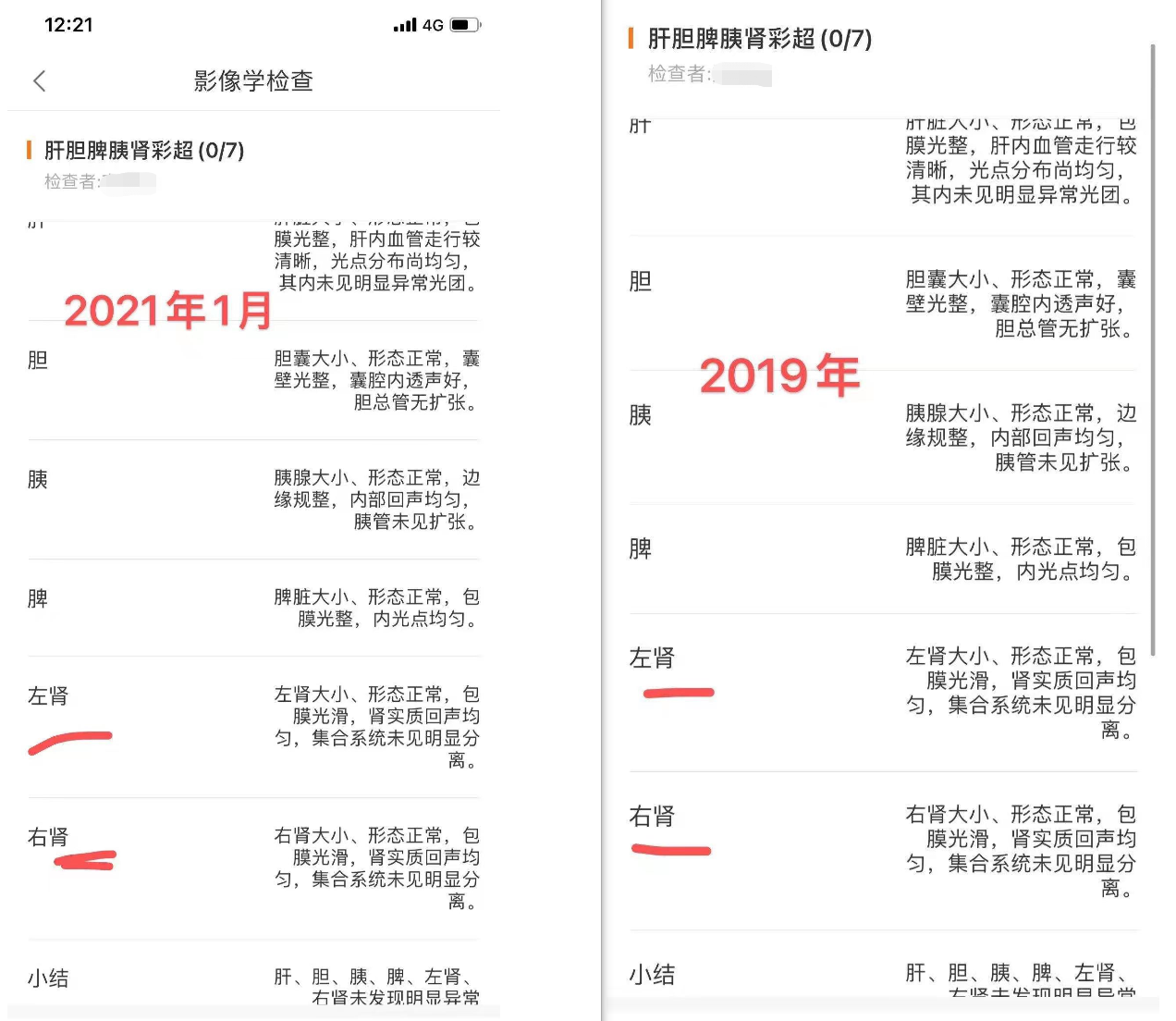 陈洁在2019年、2021年两次体检中腹部彩超均显示双肾正常。本文图片均为受访者供图