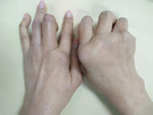 风湿扰人烦扶阳起沉疴