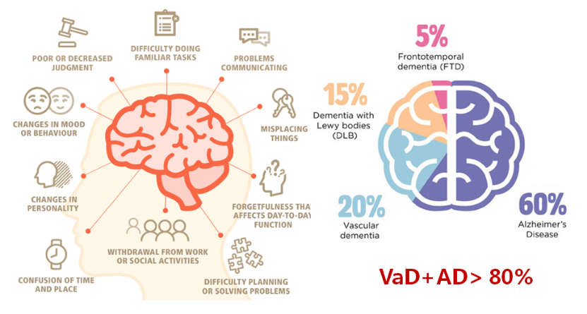 比阿尔兹海默症更可怕,被轻视的杀手—血管性痴呆|高血压|阿尔兹海默_
