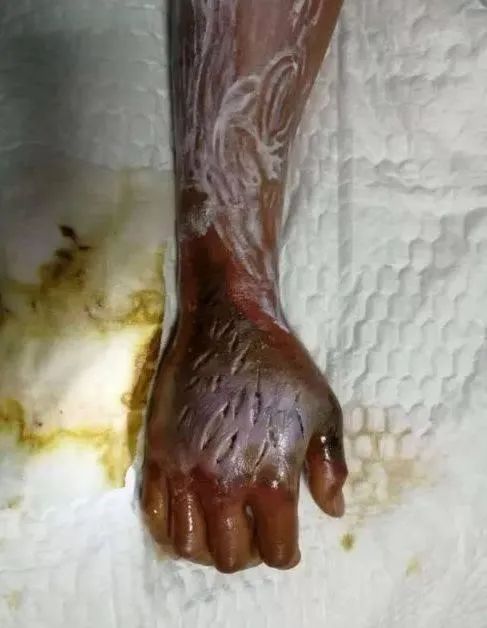 008豪克能让人致死被剧毒银环蛇咬后没痛感容易被以为没大事