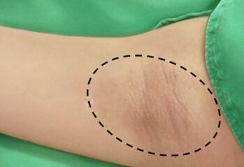 气温升高这种人体"异味"变浓了,什么办法能解决?