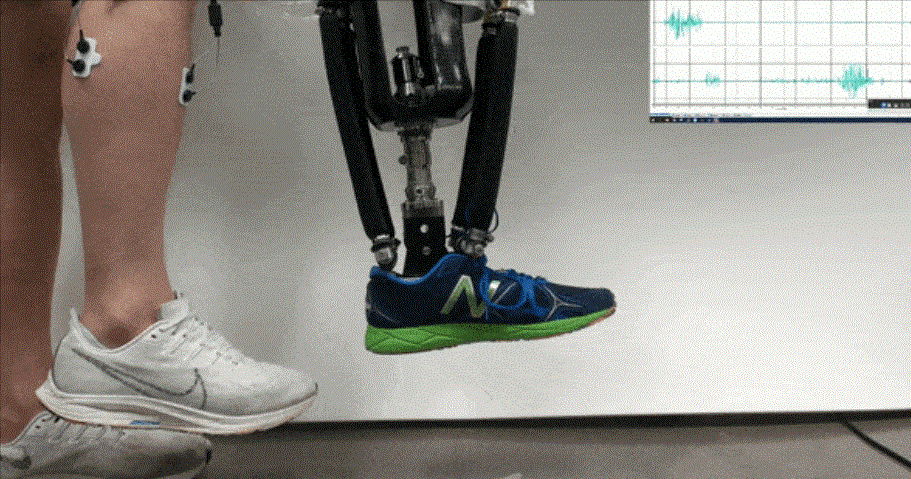让截肢者运动更加自如美国学者用大脑信号控制机器假肢