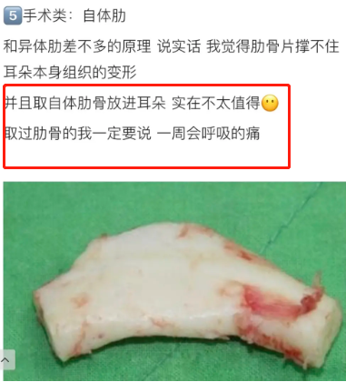 切肋骨整"招风耳",不怕后悔吗?