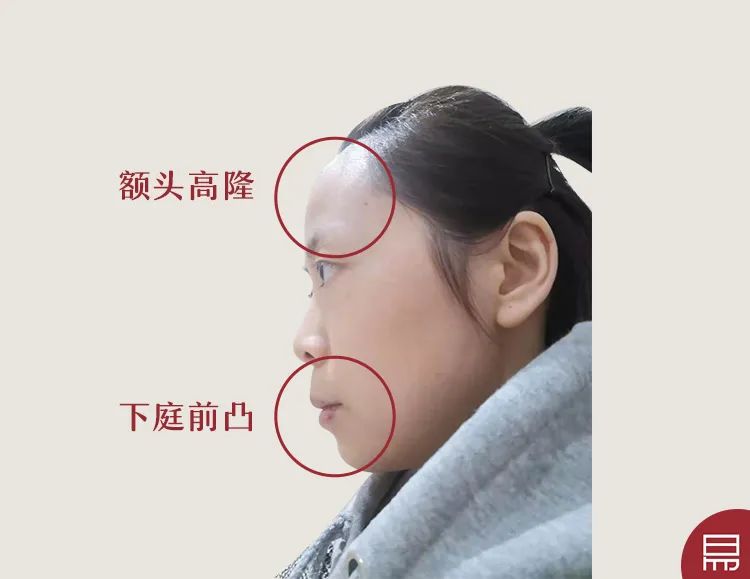 这种面相心软爱付出,看看是你吗?【真人看相】