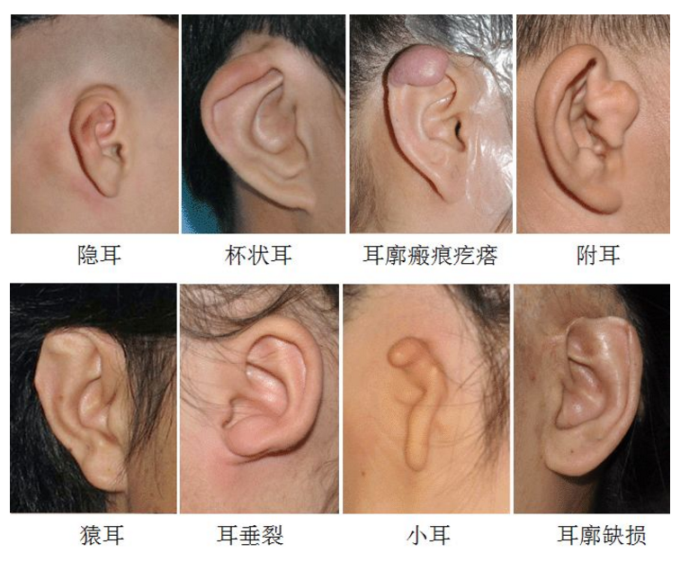 耳朵类型图片