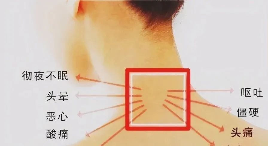 你的颈椎还好嘛