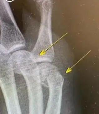 辅导作业又“出事”了！上海一爸爸气到捶墙，把自己打骨折……休闲区蓝鸢梦想 - Www.slyday.coM