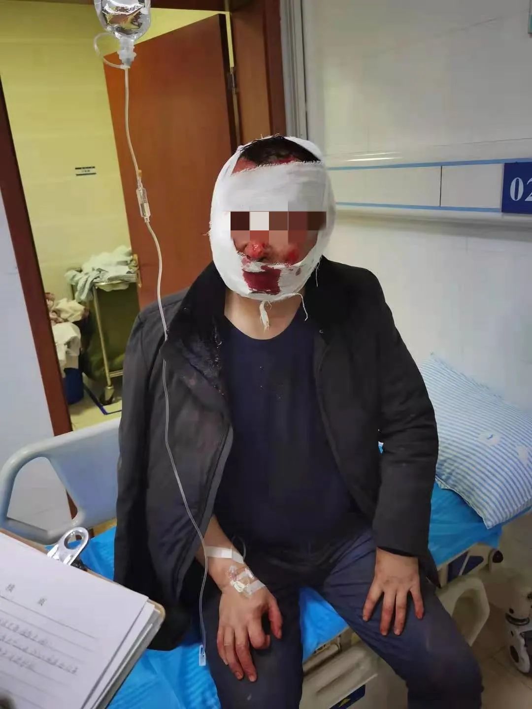 九江交警发布典型案例濂溪区一男子醉驾未系安全带头破血流