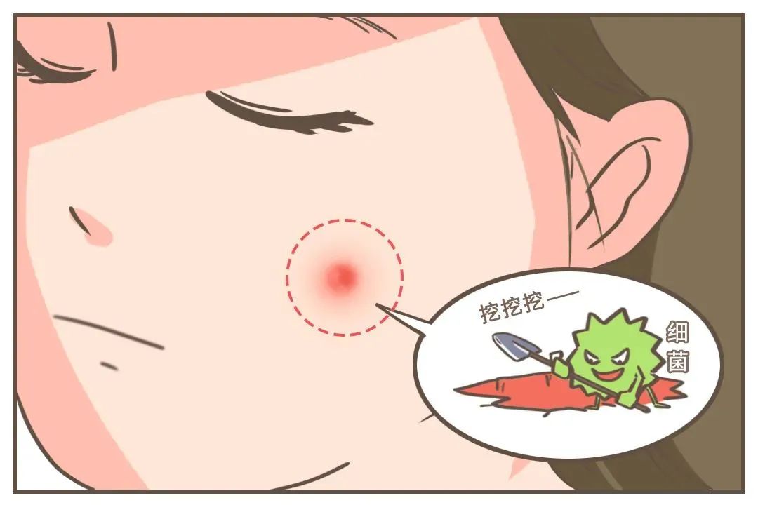 你挤痘痘的样子好像在玩命