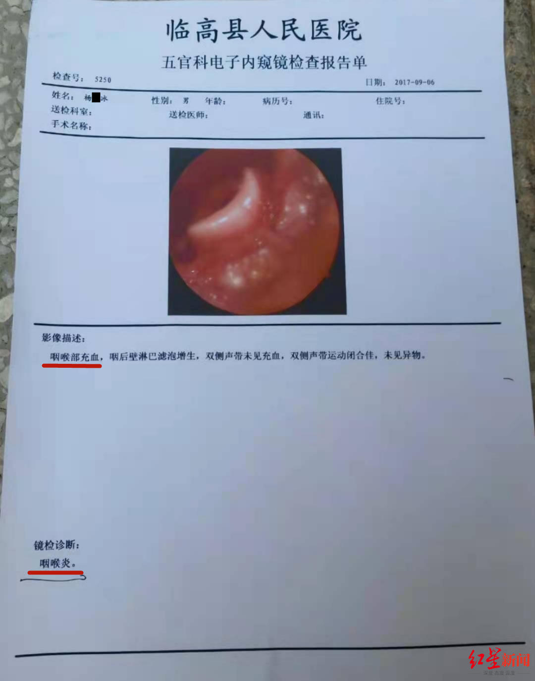 案发后数日,杨成杰孙子被检查出咽喉部充血