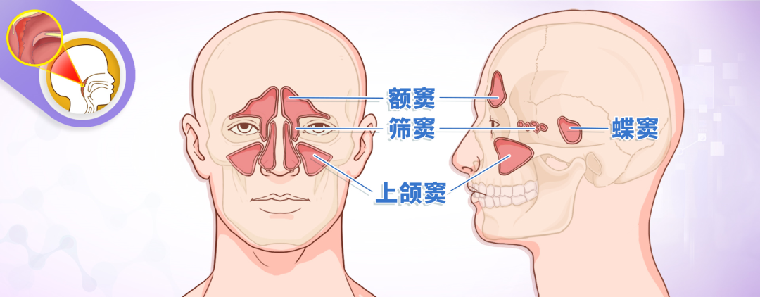 打呼嚕聽力下降鼻竇炎警惕腺樣體肥大