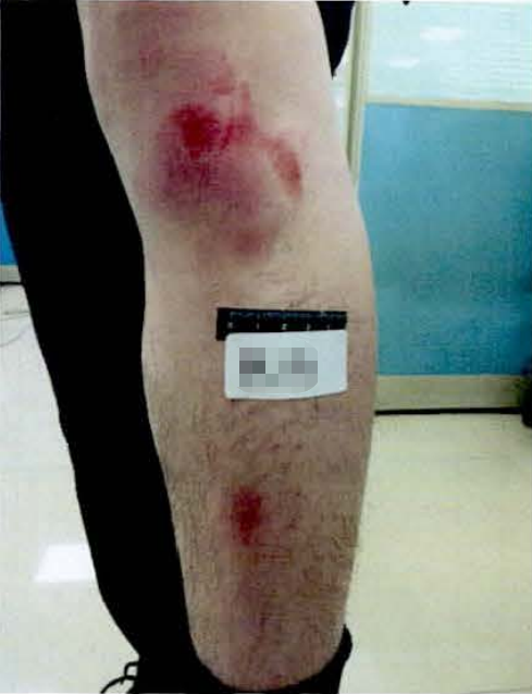 民警与社保队员伤势本文图片均为上海市青浦区人民检察院提供
