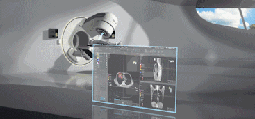 ct机器怎么分辨做一次CT，对身体的伤害有多大？_https://www.jmylbn.com_新闻资讯_第14张