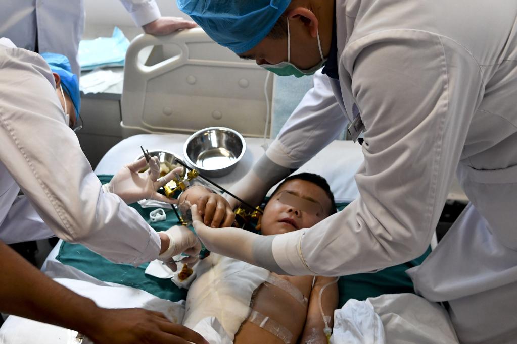 在新疆医科大学附属中医医院，医护人员为断臂男孩换药（5月4日摄）。新华社发（汤永 摄）