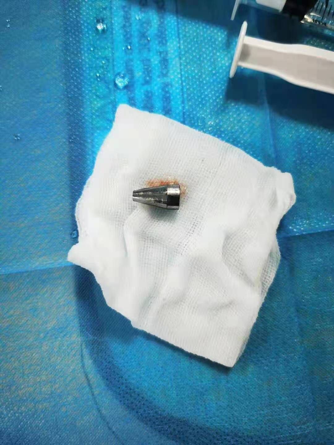 小孩咳嗽不停,医生竟从气管里取出…|气道|小孩_新浪新闻