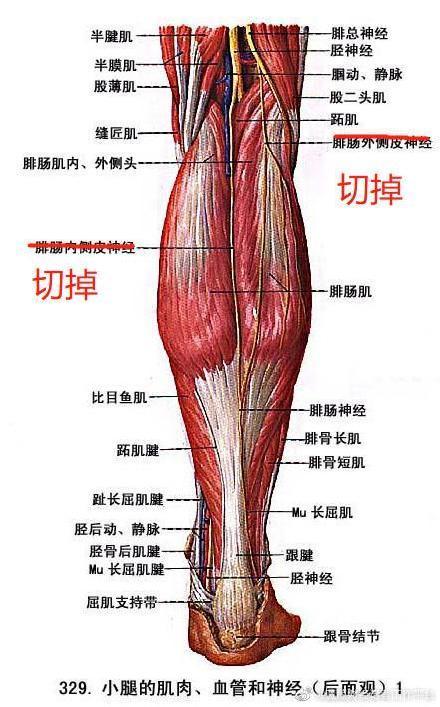 让肌肉废用性萎缩,从而达到瘦小腿后群肌的目的
