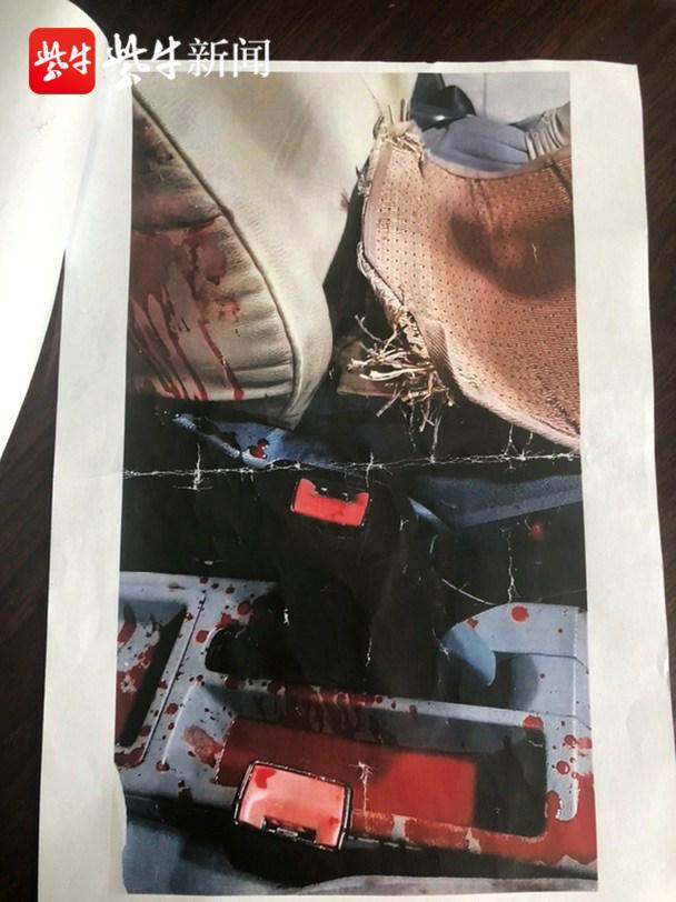 出租车变身“救护车”司机连闯红灯送“断掌”男子就医休闲区蓝鸢梦想 - Www.slyday.coM