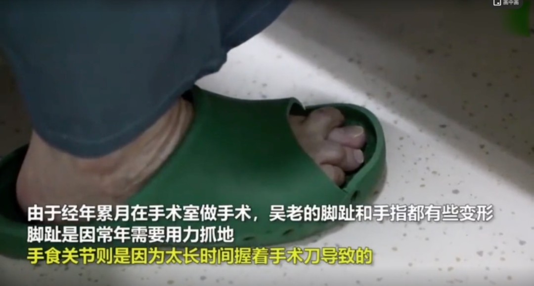 吴孟超变形的手和16000次手术