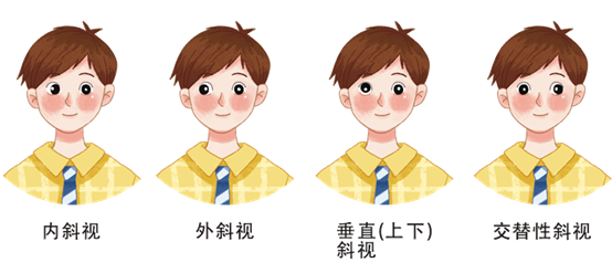 一招判断孩子是否斜视|斜视|卢秀珍|偏见_新浪新闻