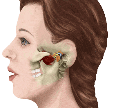 小心是颞下颌关节紊乱病!