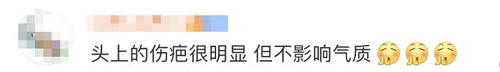 “英雄团长”祁发宝再次公开亮相 头上这道伤痕让人心疼休闲区蓝鸢梦想 - Www.slyday.coM
