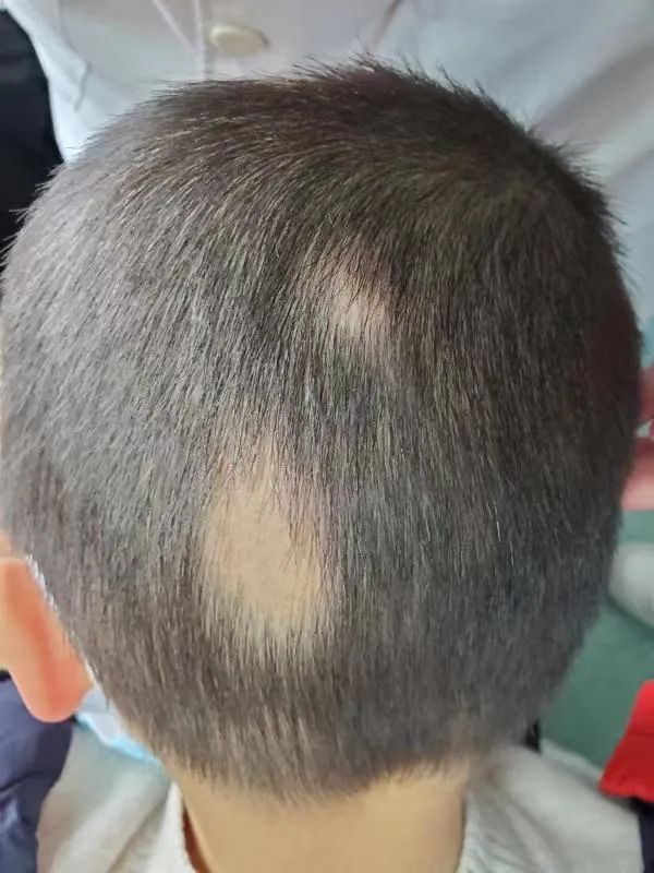 杭州母子俩同时遭遇鬼剃头背后真凶竟是