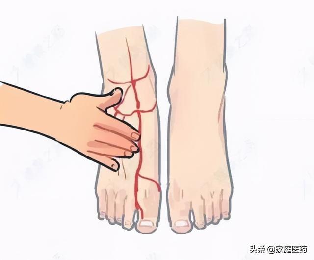 肢体抬高实验.平卧后将下肢抬高与床面成70度,保持1分钟后进行观察.