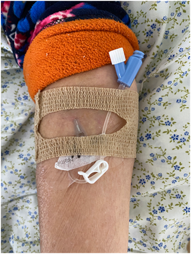 骨科护士摇身一变成发明家