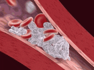 怎么区分血凝创血淋淋的教训！牙科医生劝诫，拔牙之后千万不能吸烟_https://www.jmylbn.com_新闻资讯_第8张