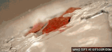 怎么区分血凝创血淋淋的教训！牙科医生劝诫，拔牙之后千万不能吸烟_https://www.jmylbn.com_新闻资讯_第9张