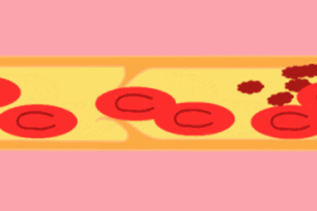 怎么区分血凝创血淋淋的教训！牙科医生劝诫，拔牙之后千万不能吸烟_https://www.jmylbn.com_新闻资讯_第10张