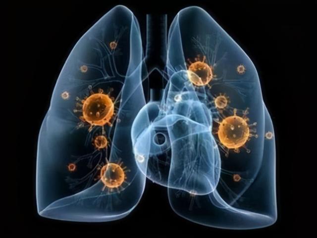 广东新增确诊病例5例、无症状感染者6例，均为境外输入休闲区蓝鸢梦想 - Www.slyday.coM