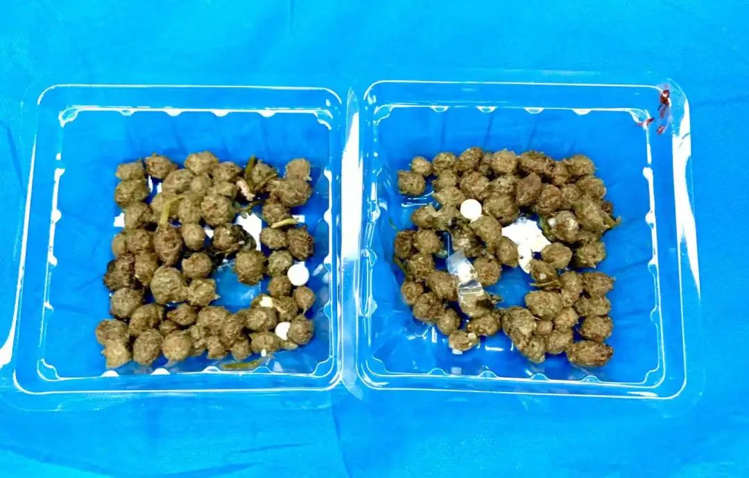 生吞近200颗！胃里密密麻麻…男子紧急送医后竟查出恶性肿瘤，医生：别再这样吃了休闲区蓝鸢梦想 - Www.slyday.coM