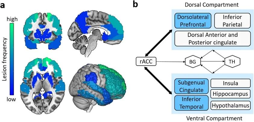 molneurodegener综述阿尔兹海默症精神症状的脑影像机制