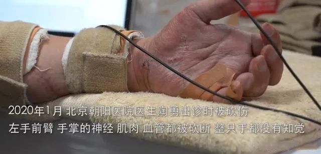 感动！陶勇医生被砍496天后，9岁女儿第一次发声：我比爸爸大6岁，我可以照顾他休闲区蓝鸢梦想 - Www.slyday.coM