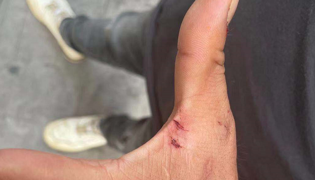 玻璃门给砸伤了可就在他进门的时候安顺的王师傅到贵阳入住了一家酒店