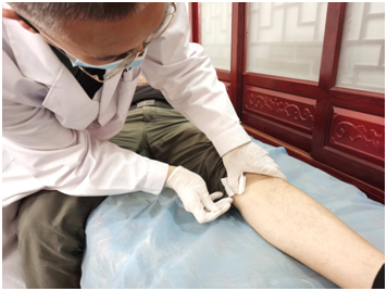 04秒解决颈肩腰腿痛他的小针刀太神奇