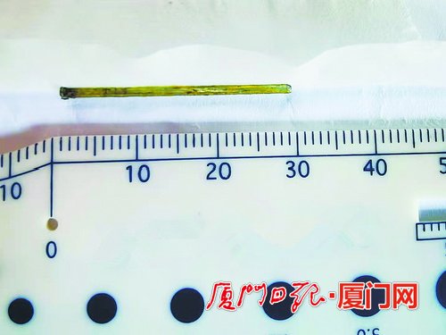 装修工人被射钉枪射穿左眼 医生取出3厘米铁钉保住患者视力