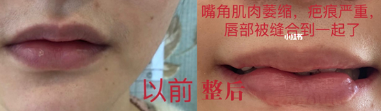 成都整形美容医院排行_成都艺星整形医院蔡灵院长连续两期登上绿宝石名医榜