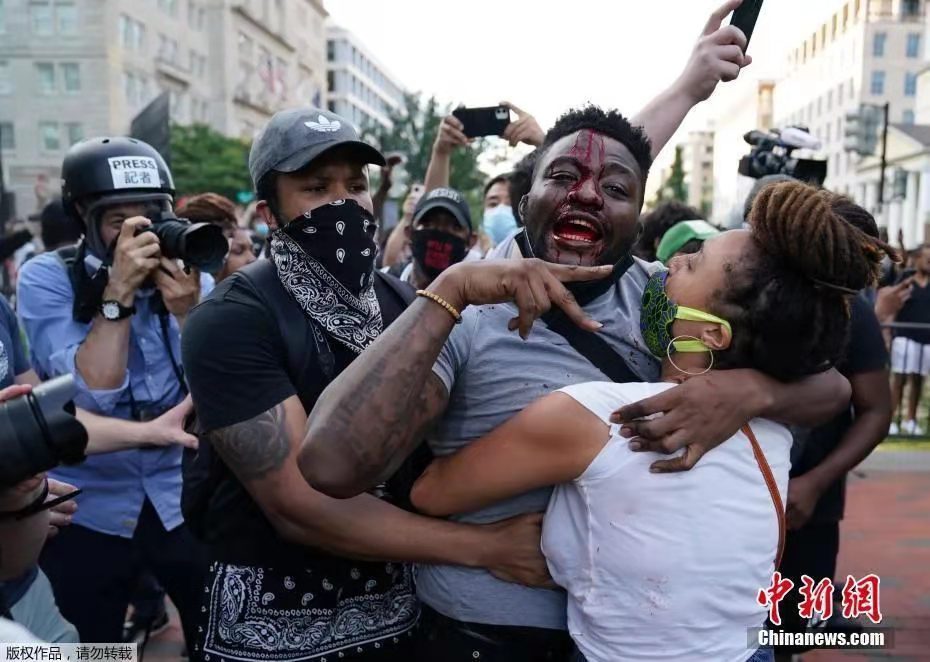 ����ͼ��������ʢ�ٰ׹��������ڿ�������������Ρ����������Ⱪ��ִ��������ʾ����У�һ��������ͷ��������Ѫ��