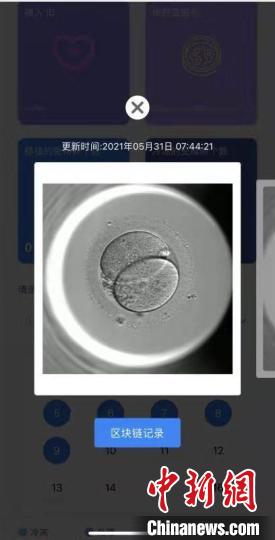 “准宝宝”的体外培养过程全程可见。　仁济医院供图