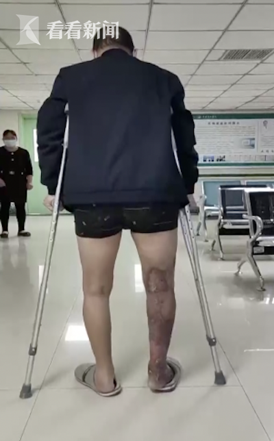 视频肌肉拉伤后处置不当六旬老汉险些把命丢了