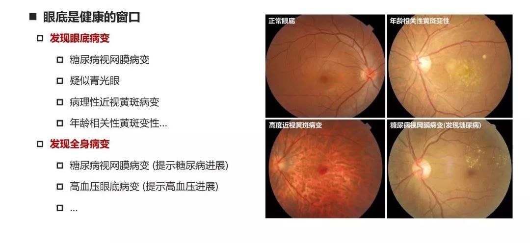 6 6爱眼日 昆明普瑞眼科为您免费眼底筛查 手机新浪网