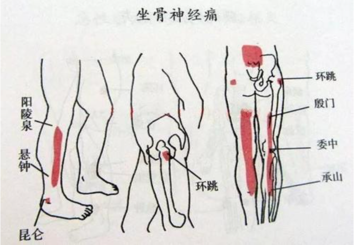 腰突了，最好的医生是自己，学会腰椎伸筋操，腿疼腿麻时候最管用休闲区蓝鸢梦想 - Www.slyday.coM