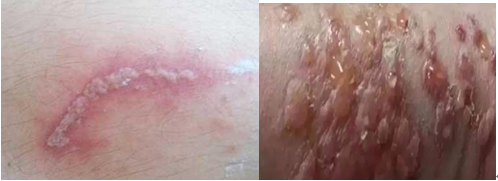 世界害虫日休闲区蓝鸢梦想 - Www.slyday.coM