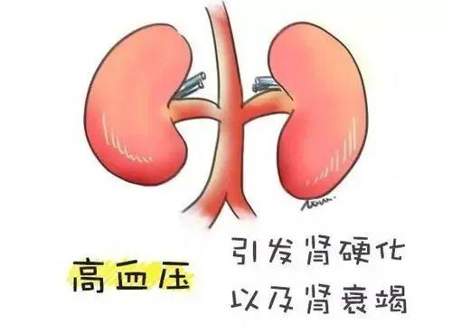 糖尿病肾病患者血压正常也要吃降压药