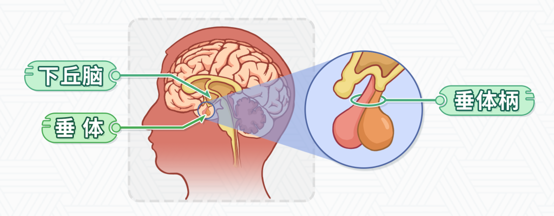 所以垂体柄相当于是连接下丘脑和垂体的桥梁,垂体柄中断或者阻断,下