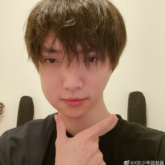 赵磊拔完智齿后肿成面包脸粉丝虽然心疼你但还是忍不住想笑