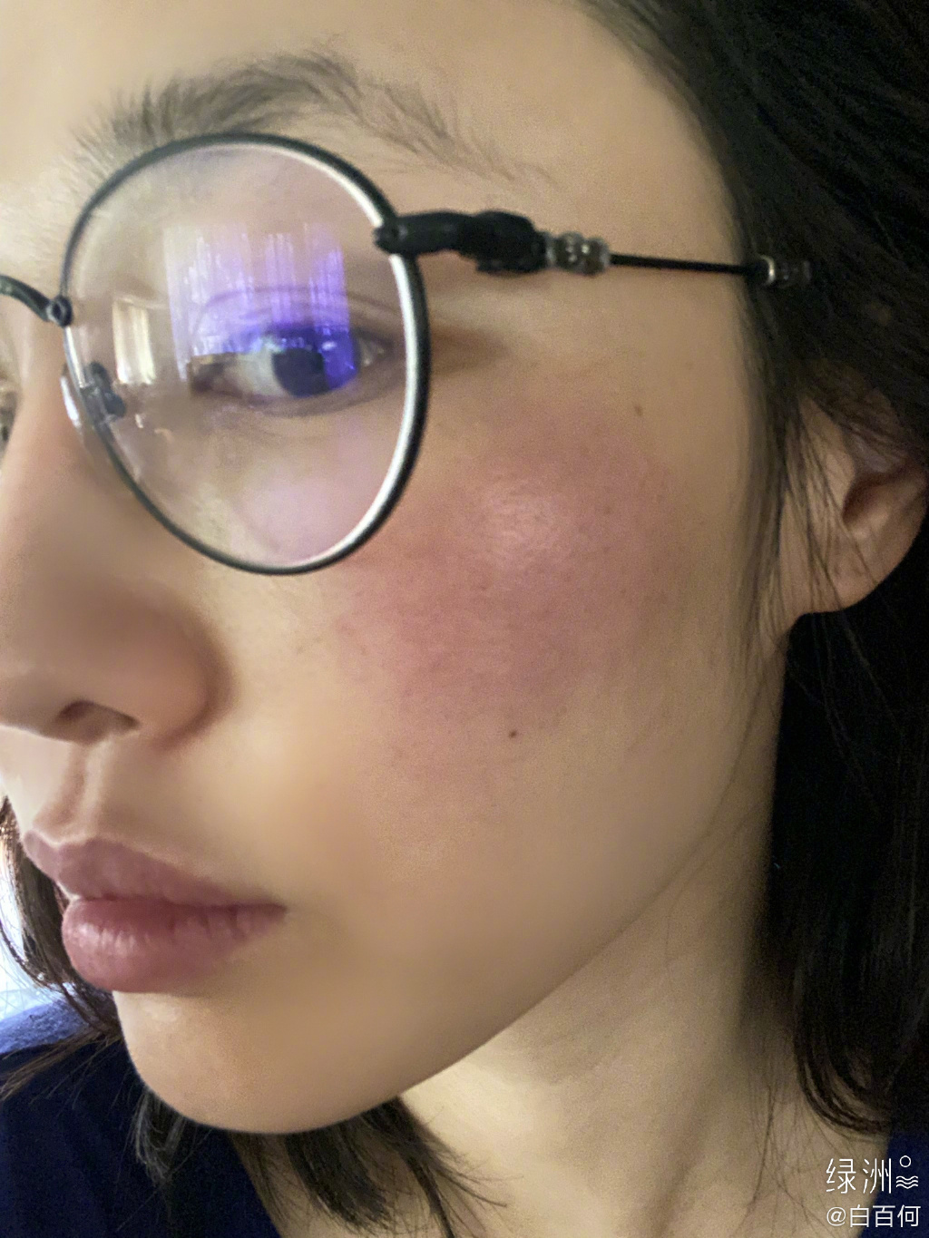 37岁白百何晒伤变"高原红"皮肤细腻度不减 自侃:化妆师疯了!