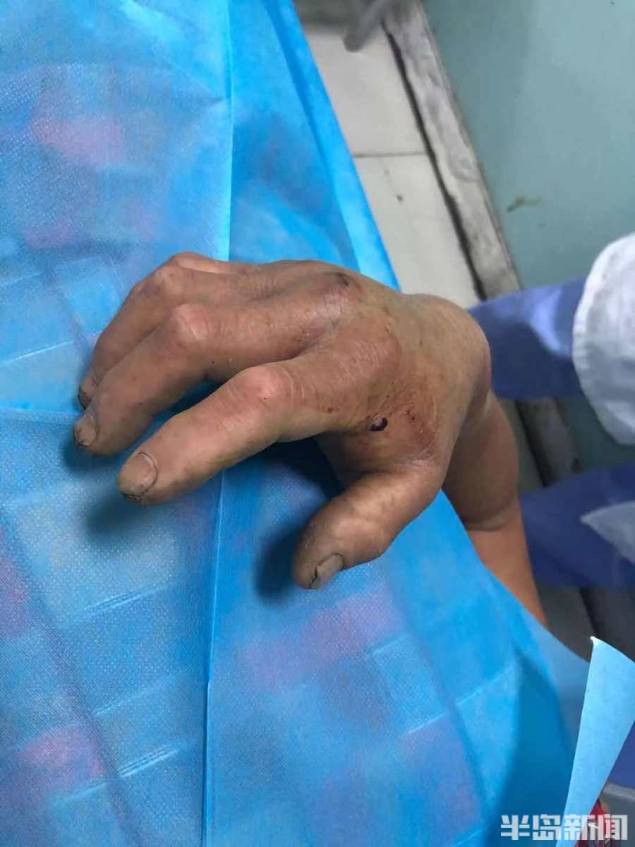 外地村民下地干活被蛇咬 李沧交警紧急开道送八医|李沧|交警|村民_新